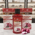 A bottle of Wellice Onion Anti-Hair Loss Hair Oil flanked by two matching product boxes, decorated with fresh red onions on a marble surface.